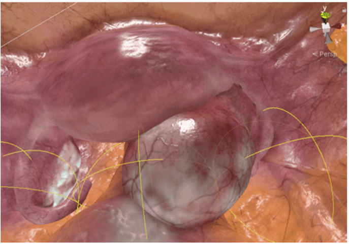 Bilateral collisions